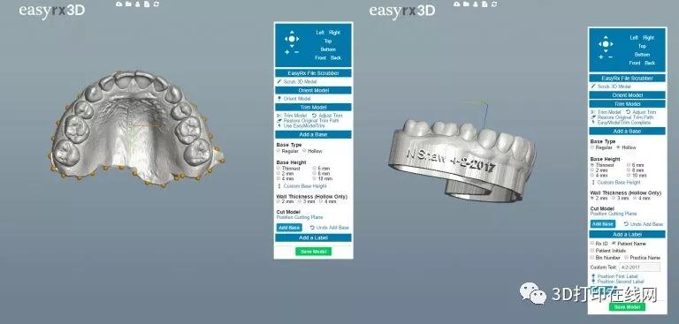 牙科3D打印 牙科3D打印